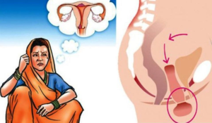 धनगढीमा २३३ महिलामा एचपिभी संक्रमण पुष्टि
